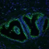 FFPE human prostate stained with Glysite Scout Glycan Screening Kit, Immunofluorescence 488 (GSK-3000, green), showing B-GNL staining.  Nuclear detail was visualized by DAPI staining (blue).