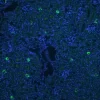 Ffpe Human Prostate Stained with Glysite Scout Glycan Screening Kit Immunofluorescence gsk Green Showing B gnl Staining Nuclear Detail Was Visualized by Dapi Staining blue Ffpe Human Prostate Stained with Glysite Scout Glycan Screening Kit Immunofluorescence gsk Green Showing B gnl Staining Nuclear Detail Was Visualized by Dapi Staining blue