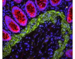 Human Colon: Rabbit Anti-Cytokeratin (AE1/AE3) and Mouse Anti-Desmin detected simultaneously with VectaFluor Duet Double Labeling Kit (DK-8828); Dylight 488 (green)/Dylight 594 (red). Mounted in VECTASHIELD PLUS with DAPI (nuclei, blue).