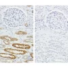 LEFT image: Serial sections of human kidney (FFPE) showing strong, specific staining using human anti-cytokeratin primary antibody detected with HOH-3000 (brown regions). RIGHT image: Negative control showing an absence of staining (no background).