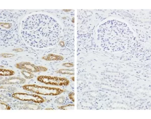 LEFT image: Serial sections of human kidney (FFPE) showing strong, specific staining using human anti-cytokeratin primary antibody detected with HOH-3000 (brown regions). RIGHT image: Negative control showing an absence of staining (no background).
