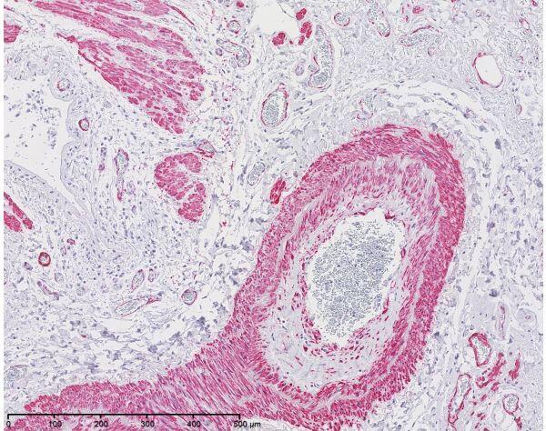 PTMScan® Phospho-MAPK/CDK Substrate Motif (PXS*P and S*PXK/R) Kit