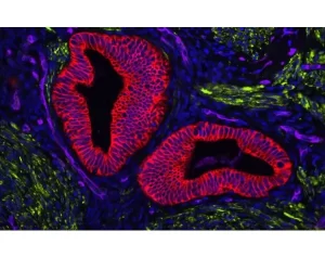 Human Uterine section (FFPE): Stained for Desmin (green) and Cytokeratin (red) using VectaFluor™ Duet Double Labeling Kit (DK-8828), and vasculature using DyLight® 649 UEA I lectin (purple). Mounted in VECTASHIELD® Vibrance™ with DAPI (blue)