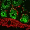 Colon (frozen, double label): Multi-Cytokeratin (m), MOM Fluorescein Kit (green); Desmin (m), MOM Basic Kit, Texas Red Avidin DCS (red).