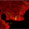 Tonsil (frozen, double label): Ki67 (m), MOM Fluorescein Kit (green); Pan-Cytokeratin (m), MOM Basic Kit, Texas Red Avidin DCS (red).