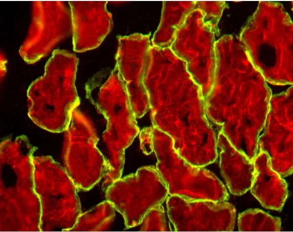 Skeletal Muscle (frozen, unfixed; double label): Alpha-sarcoglycan (m), MOM Fluorescein Kit (green); Muscle Specific Actin (M), MOM basic Kit, Texas Red Avidin DCS (red).