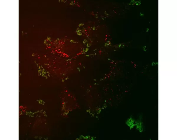 CARS and TPF imaging of Huh-7 cells transfected with FL- HCV RNA. More in "Additional Info". Courtesy of Jennifer Haley, Sylvie Belanger, Adrian Pegoraro, Albert Stolow, and John P. Pezacki, The Steacie Inst. for Molecular Sciences, NRCC, Canada.