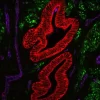Human Uterine section (FFPE): Stained for Desmin (green) and Cytokeratin (red) using VectaFluor™ Duet Double Labeling Kit (DK-8828), and vasculature using DyLight® 649 UEA I lectin (purple). Mounted in VECTASHIELD® Vibrance™ Antifade Mounting Medium.