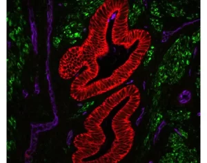 Human Uterine section (FFPE): Stained for Desmin (green) and Cytokeratin (red) using VectaFluor™ Duet Double Labeling Kit (DK-8828), and vasculature using DyLight® 649 UEA I lectin (purple). Mounted in VECTASHIELD® Vibrance™ Antifade Mounting Medium.