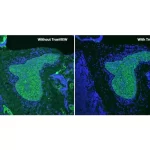 Human Tonsil ffpe Section Stained for Aeae Using Fluorescein Label green Treated with Trueview and Mounted with Vectashield Vibrance Antifade Mounting Medium with Dapi nuclei Blue Human Tonsil ffpe Section Stained for Aeae Using Fluorescein Label green Treated with Trueview and Mounted with Vectashield Vibrance Antifade Mounting Medium with Dapi nuclei Blue