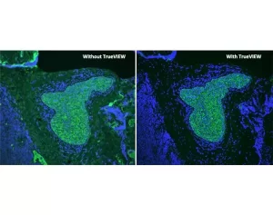 Human tonsil (FFPE); Section stained for AE1/AE3 using fluorescein label (green). Treated with TrueVIEW and mounted with VECTASHIELD Vibrance Antifade Mounting Medium with DAPI (nuclei blue). Human tonsil (FFPE); Section stained for AE1/AE3 using fluorescein label (green). Treated with TrueVIEW and mounted with VECTASHIELD Vibrance Antifade Mounting Medium with DAPI (nuclei blue).