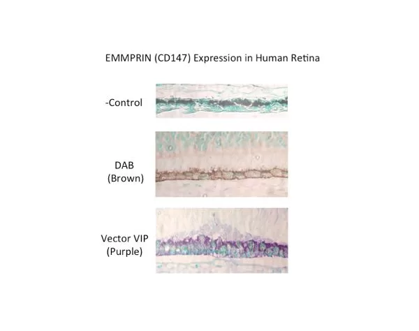 EMMPRIN (CD147) Expression in human retina. Image kindly provided by Gail Seigel, University of Buffalo, Center for Hearing and Deafness.