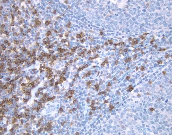 Tonsil: Bcl-2 (m), ImmPRESS Anti-Mouse Ig Kit, DAB Substrate Kit (brown). Hematoxylin QS counterstain (blue).