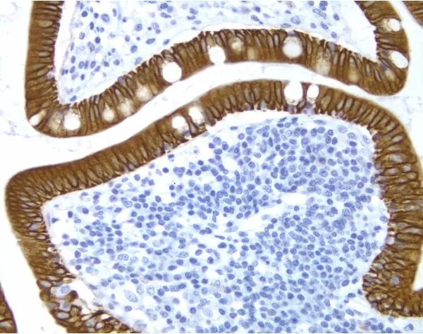 Small Bowel: Cytokeratin 8/18 (m), ImmPRESS Anti-Mouse Ig Kit, DAB Substrate Kit (brown), Hematoxylin QS (blue).