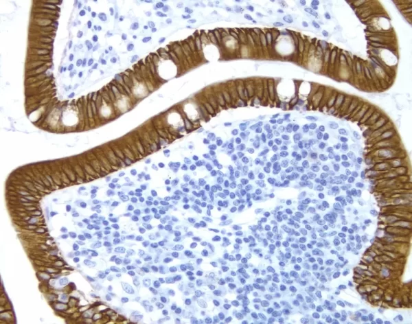Small Bowel: Cytokeratin 8/18 (m), ImmPRESS Anti-Mouse Ig Kit, DAB Substrate Kit (brown), Hematoxylin QS (blue).