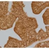 Prostate: anti-PSA (rabbit MAb), ImmPRESS HRP Anti-Rabbit IgG (made in goat), DAB Substrate Kit (brown).