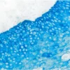 Tonsil Cytokeratin aeae m Immpress ap Reagent Vector Blue Ap Substrate blue Tonsil Cytokeratin aeae m Immpress ap Reagent Vector Blue Ap Substrate blue