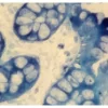 Colon: AE1/AE3 (m), ImmPRESS-AP Anti-Mouse IgG Kit, BCIP/NBT (indigo), viewed under bright field microscopy.Colon: AE1/AE3 (m), ImmPRESS-AP Anti-Mouse IgG Kit, BCIP/NBT (indigo), viewed under bright field microscopy. Colon:  AE1/AE3 (m), ImmPRESS-AP Anti-Mouse IgG Kit, BCIP/NBT (indigo), viewed under bright field microscopy.