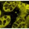 Colon: AE1/AE3 (m), ImmPRESS-AP Anti-Mouse IgG Kit, BCIP/NBT (indigo), viewed under fluorescence microscopy. Colon:  AE1/AE3 (m), ImmPRESS-AP Anti-Mouse IgG Kit, BCIP/NBT (indigo), viewed under fluorescence microscopy.