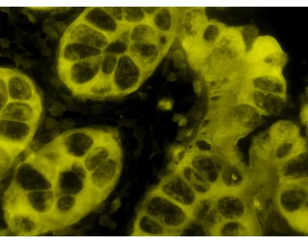 Colon: AE1/AE3 (m), ImmPRESS-AP Anti-Mouse IgG Kit, BCIP/NBT (indigo), viewed under fluorescence microscopy.