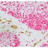 Tonsil (paraffin): ImmPRESS Duet Kit (MP-7724) used to detect mouse anti- CD34 (ImmPACT DAB, brown) and rabbit anti-Ki67 (ImmPACT Vector® Red, magenta) antibodies.