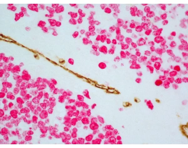 Tonsil (paraffin): ImmPRESS Duet Kit (MP-7724) used to detect mouse anti- CD34 (ImmPACT DAB, brown) and rabbit anti-CD3 (ImmPACT Vector® Red, magenta) antibodies.