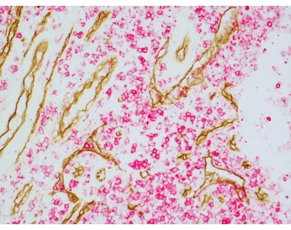 Tonsil (paraffin): ImmPRESS Duet Kit (MP-7724) used to detect mouse anti- CD34 (ImmPACT DAB, brown) and rabbit anti-Ki67 (ImmPACT Vector® Red, magenta) antibodies.