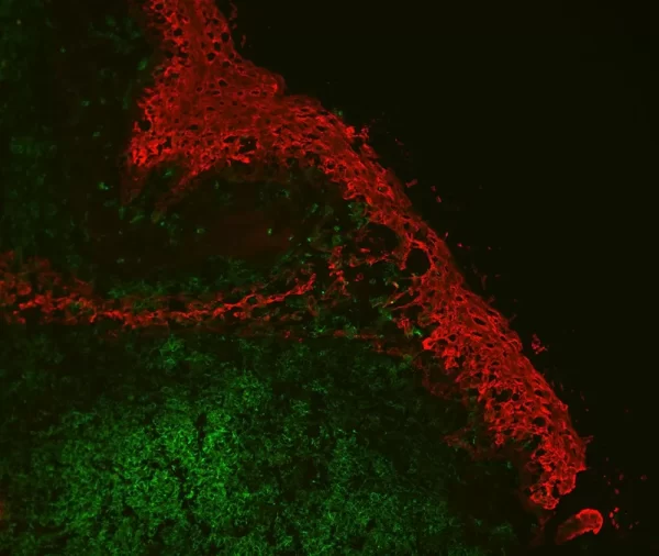 Tonsil: Rabbit Anti-CD3 and Mouse Anti-C11 detected simultaneously with VectaFluor Duet Immunofluorescence Double Labeling Kit, DyLight 488 Anti-Rabbit (green)/DyLight 594 Anti-Mouse (red). Mounted in VECTASHIELD HardSet Mounting Medium with DAPI.