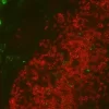 Colon: Mouse Anti-Desmin and Rabbit (monoclonal) Anti-CD3 detected simultaneously with VectaFluor Duet Immunofluorescence Double Labeling Kit, DyLight 488 Anti-Mouse (green)/DyLight 594 Anti-Rabbit (red). Mounted in VECTASHIELD HardSet Mounting Medium.