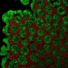 Colon: Mouse Anti-Cytokeratin (AE1/AE3) and Rabbit Anti-Vimentin detected simultaneously with VectaFluor Duet Immunofluorescence Double Labeling Kit, DyLight 488 Anti-Mouse (green)/DyLight 594 Anti-Rabbit (red). Mounted in VECTASHIELD HardSet Mounting M