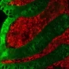 Colon: Mouse Anti-Cytokeratin (AE1/AE3) and Rabbit Anti-Vimentin detected simultaneously with VectaFluor Duet Immunofluorescence Double Labeling Kit, DyLight 488 Anti-Mouse (green)/DyLight 594 Anti-Rabbit (red). Mounted in VECTASHIELD HardSet Mounting M