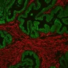 Prostate: Rabbit Anti-PSA MAb and Mouse Anti-Smooth Muscle Actin detected simultaneously with VectaFluor Duet Immunofluorescence Double Labeling Kit, DyLight 488 Anti-Rabbit (green)/DyLight 594 Anti-Mouse (red). Mounted in VECTASHIELD HardSet Mounting M