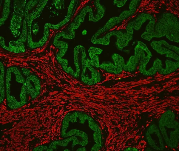 Prostate: Rabbit Anti-PSA MAb and Mouse Anti-Smooth Muscle Actin detected simultaneously with VectaFluor Duet Immunofluorescence Double Labeling Kit, DyLight 488 Anti-Rabbit (green)/DyLight 594 Anti-Mouse (red). Mounted in VECTASHIELD HardSet Mounting M