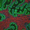Prostate: Rabbit Anti-PSA MAb and Mouse Anti-Smooth Muscle Actin detected simultaneously with VectaFluor Duet Immunofluorescence Double Labeling Kit, DyLight 488 Anti-Rabbit (green)/DyLight 594 Anti-Mouse (red). Mounted in VECTASHIELD HardSet Mounting M