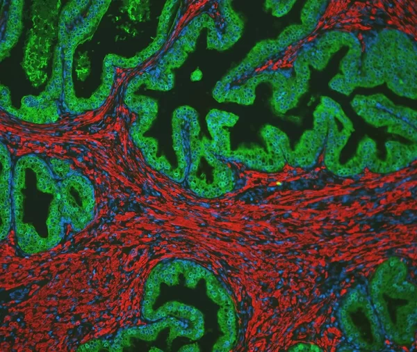 Prostate: Rabbit Anti-PSA MAb and Mouse Anti-Smooth Muscle Actin detected simultaneously with VectaFluor Duet Immunofluorescence Double Labeling Kit, DyLight 488 Anti-Rabbit (green)/DyLight 594 Anti-Mouse (red). Mounted in VECTASHIELD HardSet Mounting M