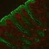 Colon: Mouse Anti-Cytokeratin (AE1/AE3) and Rabbit Anti-Vimentin (cocktail of both primary antibodies) detected simultaneously with VectaFluor Duet Immunofluorescence Double Labeling Kit, DyLight 488 Anti-Mouse (green)/DyLight 594 Anti-Rabbit (red). Mou