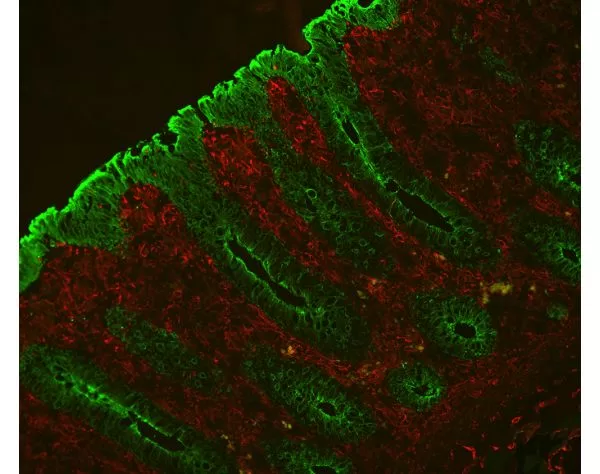 Colon: Mouse Anti-Cytokeratin (AE1/AE3) and Rabbit Anti-Vimentin (cocktail of both primary antibodies) detected simultaneously with VectaFluor Duet Immunofluorescence Double Labeling Kit, DyLight 488 Anti-Mouse (green)/DyLight 594 Anti-Rabbit (red). Mou