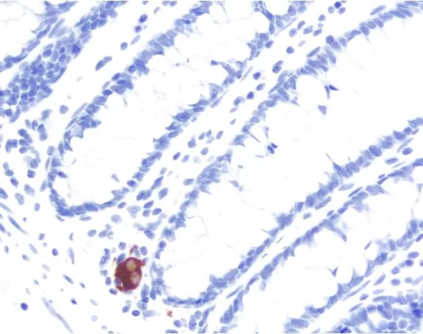 Colon: Peripherin (m, VP-P968), ImmPRESS Anti-Mouse Ig Kit, ImmPACT NovaRED (red) substrate. Hematoxylin QS (blue) counterstain.