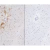 Left: Cat brain stained with mouse antibody against GFAP and detected with ImmPRESS VR HRP Anti-Mosue IgG and ImmPACT DAB Substrate. Counterstainedwith Vector Hematoxylin QS. Right: No mouse primary antibody negative control section displaying no back Left:  Cat brain stained with mouse antibody against GFAP and detected with ImmPRESS VR HRP Anti-Mosue IgG and ImmPACT DAB Substrate.  Counterstainedwith Vector Hematoxylin QS.  Right:  No mouse primary antibody negative control section displaying no back