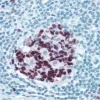 Peyers Patch: ImmPRESS anti-rabbit Ig using Ki67 rabbit primary antibody with Vector NovaRed (red) substrate. Hematoxylin QS counterstain (blue).