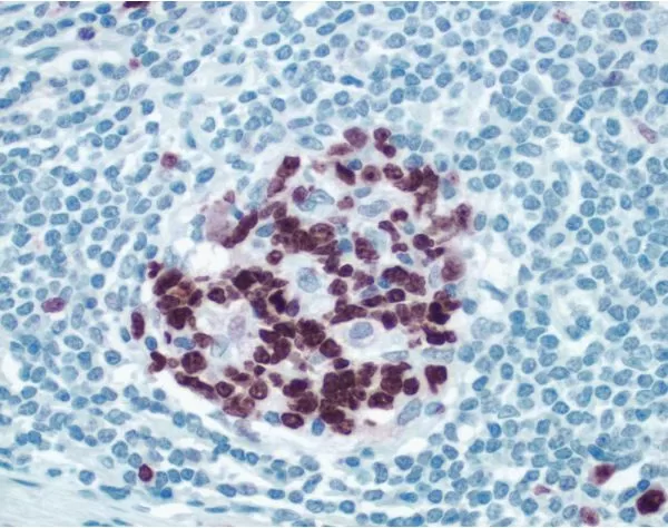 Peyers Patch: ImmPRESS anti-rabbit Ig using Ki67 rabbit primary antibody with Vector NovaRed (red) substrate. Hematoxylin QS counterstain (blue).
