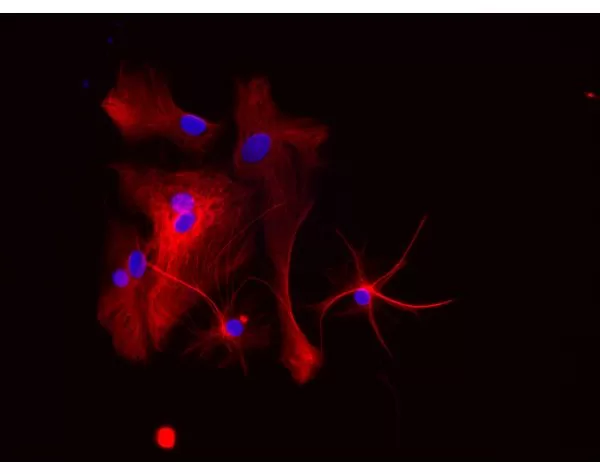 Astrocytes: Stained for GFAP and detected with Dylight 594 labeled secondary antibody. Mounted in VECTASHIELD HardSet Mounting Medium with DAPI. Image courtesy of Dr Emma East, Department of Life Sciences, The Open University, U.K.*