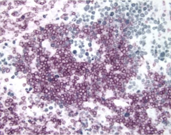 Tonsil (double label): CD3 (m), ImmPRESS Anti-Mouse Ig Reagent, Vector VIP substrate (purple); Ki67 (m), ImmPRESS Anti-Mouse Ig Reagent, Vector SG substrate (blue/gray).