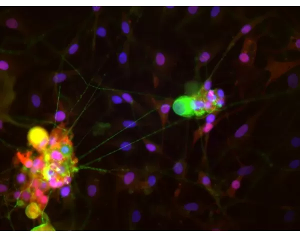 Dorsal root ganglia cells (neurons and satellite glia) - double label. BIII tubulin, DyLight 488 labeled secondary antibody (green). S100, DyLight 594 labeled secondary antibody (red). Mounted in VECTASHIELD HardSet Mounting Medium with DAPI. Image c
