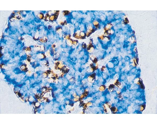 Pancreas (double label): Beta cells (blue, Vector Blue), Alpha cells (brown, Vector DAB).