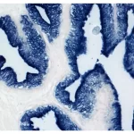 Prostate: PSA (m), VECTASTAIN ABC-AP Mouse IgG Kit, BCIP/NBT (indigo), viewed under bright field microscopy.