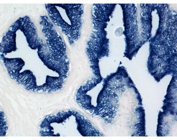 Prostate: PSA (m), VECTASTAIN ABC-AP Mouse IgG Kit, BCIP/NBT (indigo), viewed under bright field microscopy.