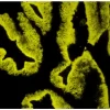 Prostate: PSA (m), VECTASTAIN ABC-AP Mouse IgG Kit, BCIP/NBT (indigo), viewed under fluorescence microscopy.