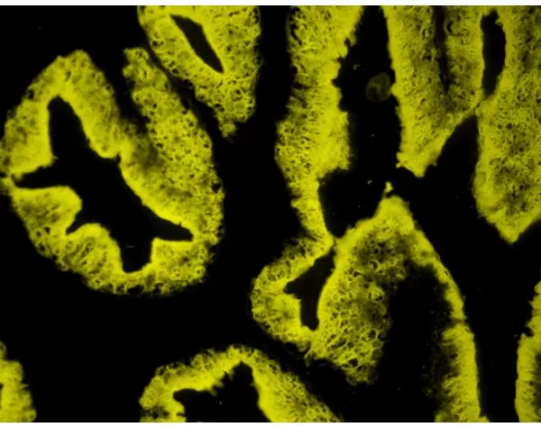 Prostate: PSA (m), VECTASTAIN ABC-AP Mouse IgG Kit, BCIP/NBT (indigo), viewed under fluorescence microscopy.