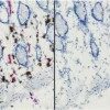 Endogenous alkaline phosphatase (AP) and peroxidase (HRP) activities in frozen intestine revealed with Vector Red AP Substrate (red) and ImmPACT DAB HRP Substrate (brown) (left). Same substrates used on BLOXALL Solution-treated tissue (right). BLOXALL B
